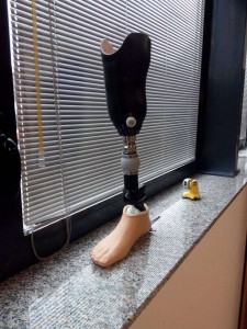 Una protesi per alpinismo realizzata da Marco Avaro con la DeltaWASP